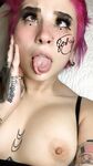 Onlyfans hot BirthDefective nude gallery leaks pack 4
